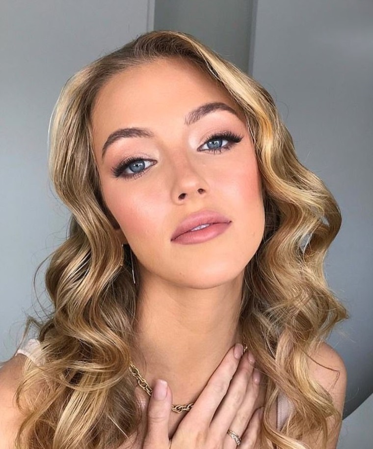 وفاة ملكة جمال العالم المحتملة بعد سقوطها عن حصان