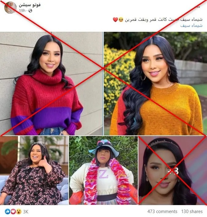 صور للفنانة شيماء سيف بعد فقدان الوزن تقلب مواقع التواصل!