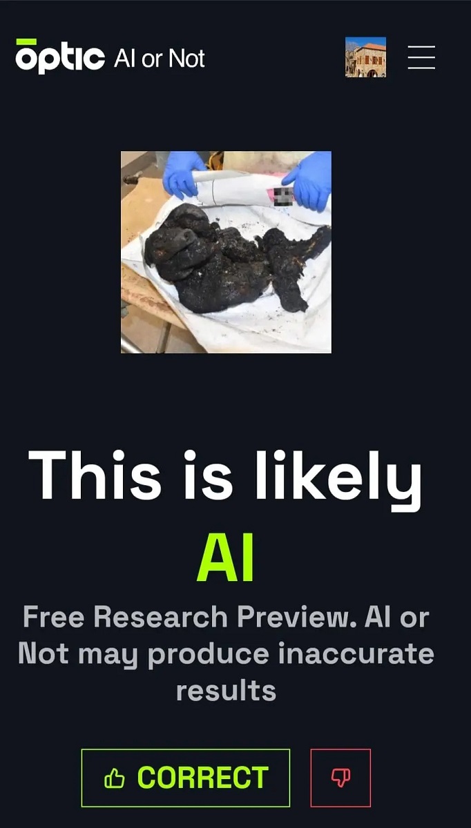 لم يره أحد .. حقيقة صورة الطفل الإسرائيلي المحروق!