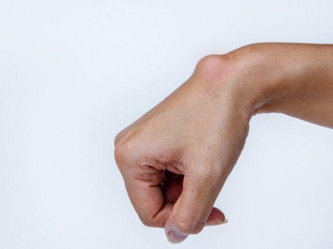 5 علامات تكشفها يداك عن حالتك الصحية