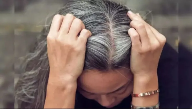 الشيب المبكر يغزو الجيل الجديد وخبراء الصحة يحذرون