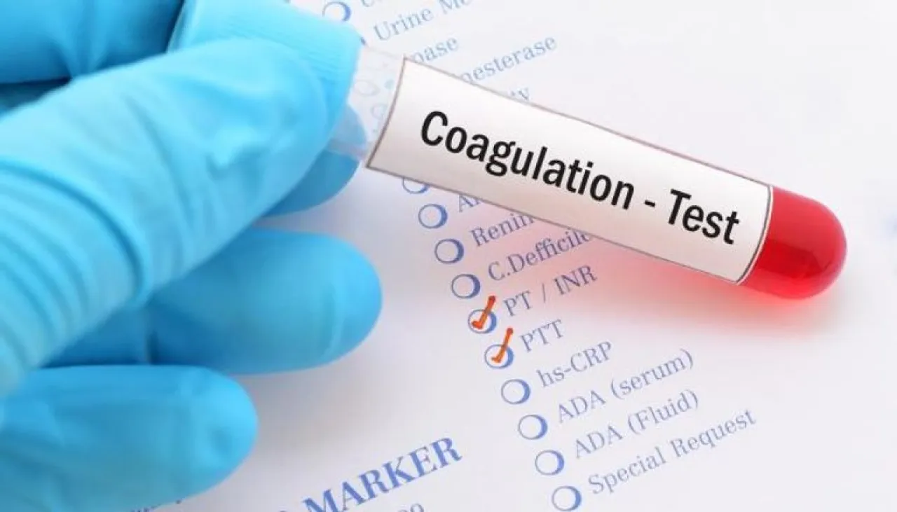 سر صحي مذهل لصيام رمضان دراسة تكشف دوره في الحماية من الجلطات