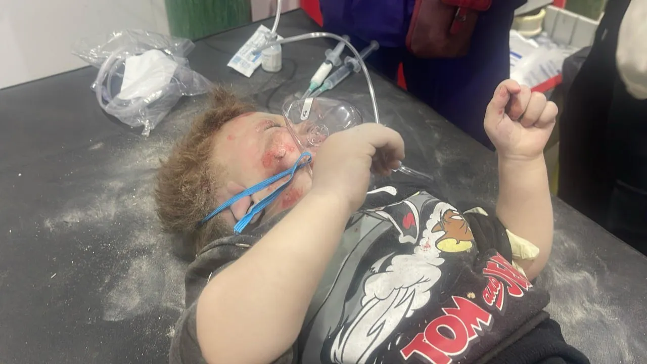 34 شهيدا وعشرات المصابين نتيجة العدوان على غزة