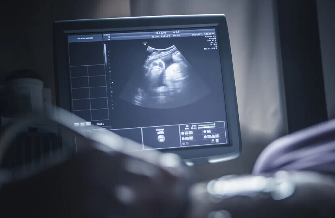 تحذير علمي مواد كيميائية في المنتجات المنزلية قد تعيق نمو دماغ الجنين