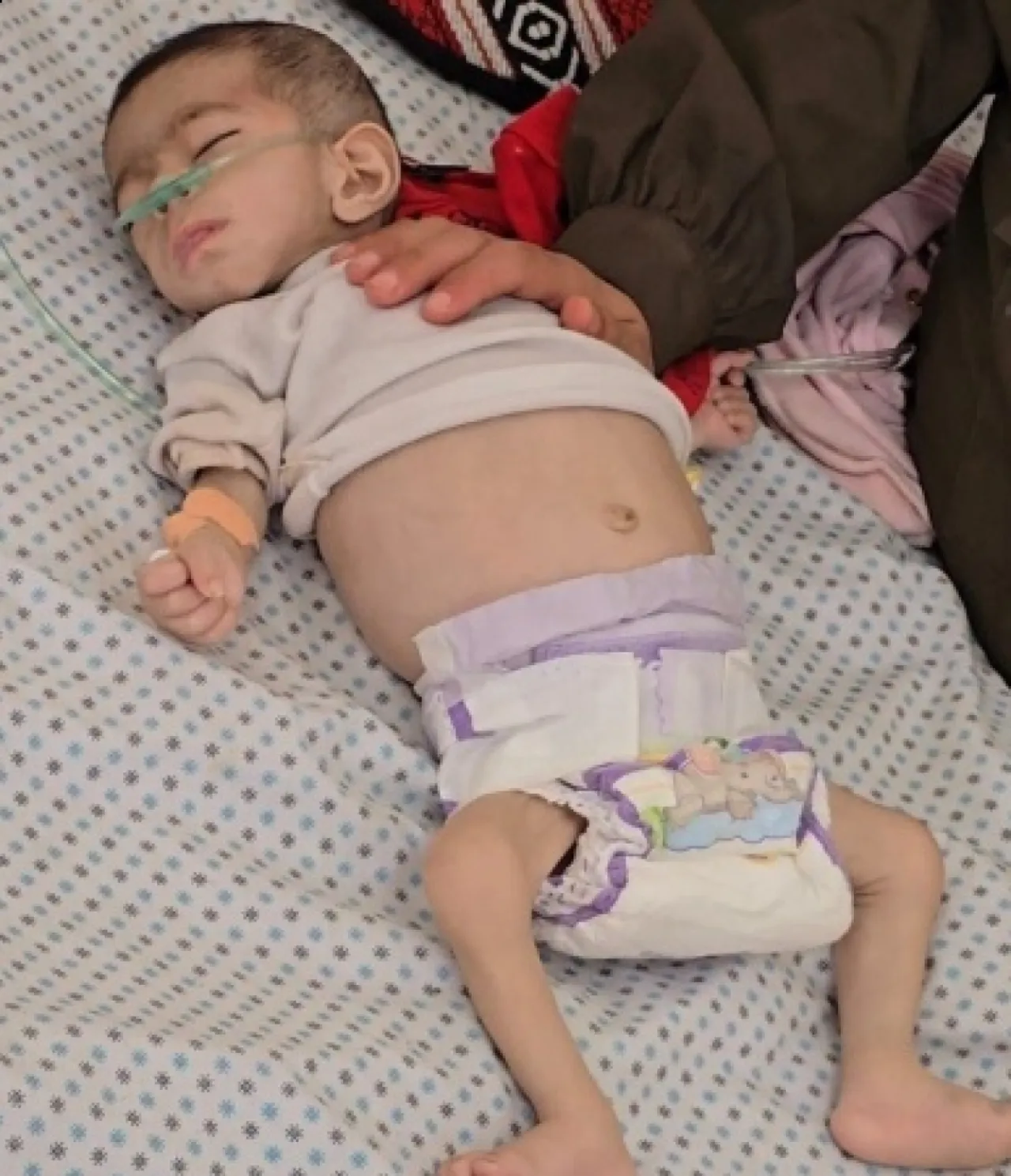 استشهاد طفلة في غزة بسبب المجاعة ما يرفع الحصيلة إلى 54