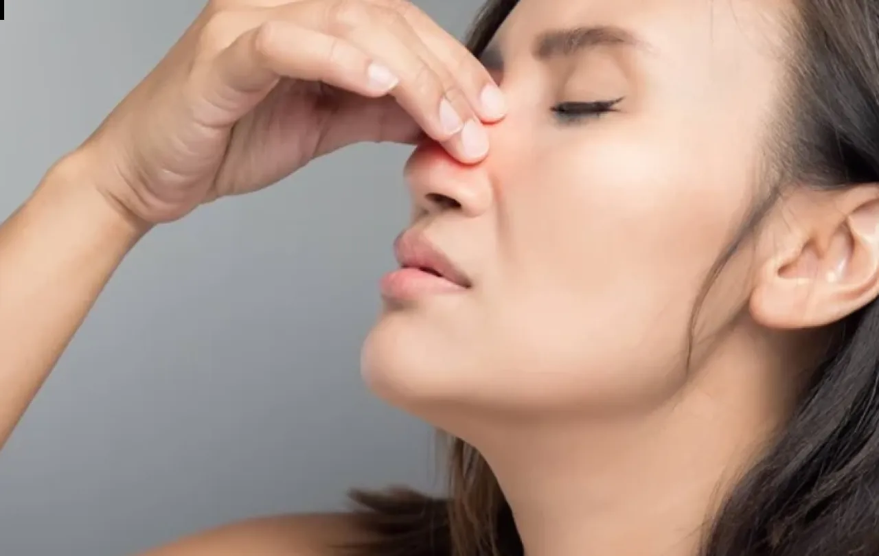 خبراء ينصحون بفحص الضغط بعد نزيف الأنف