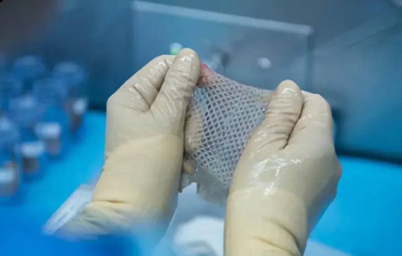 الصحة الكويتية تعلن تأسيس أول بنك للجلد لعلاج حالات الحروق