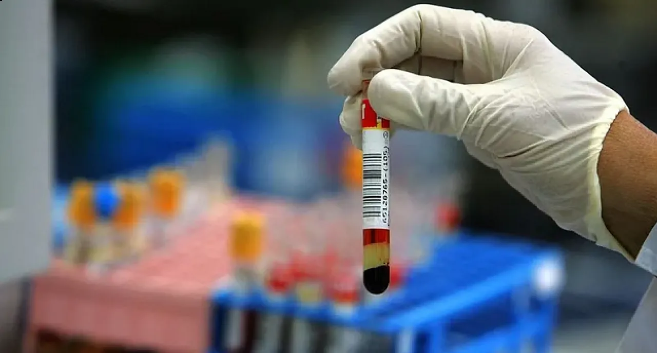 لأول مرة في العالم اختبار دم بديل للجراحة في تشخيص السرطان