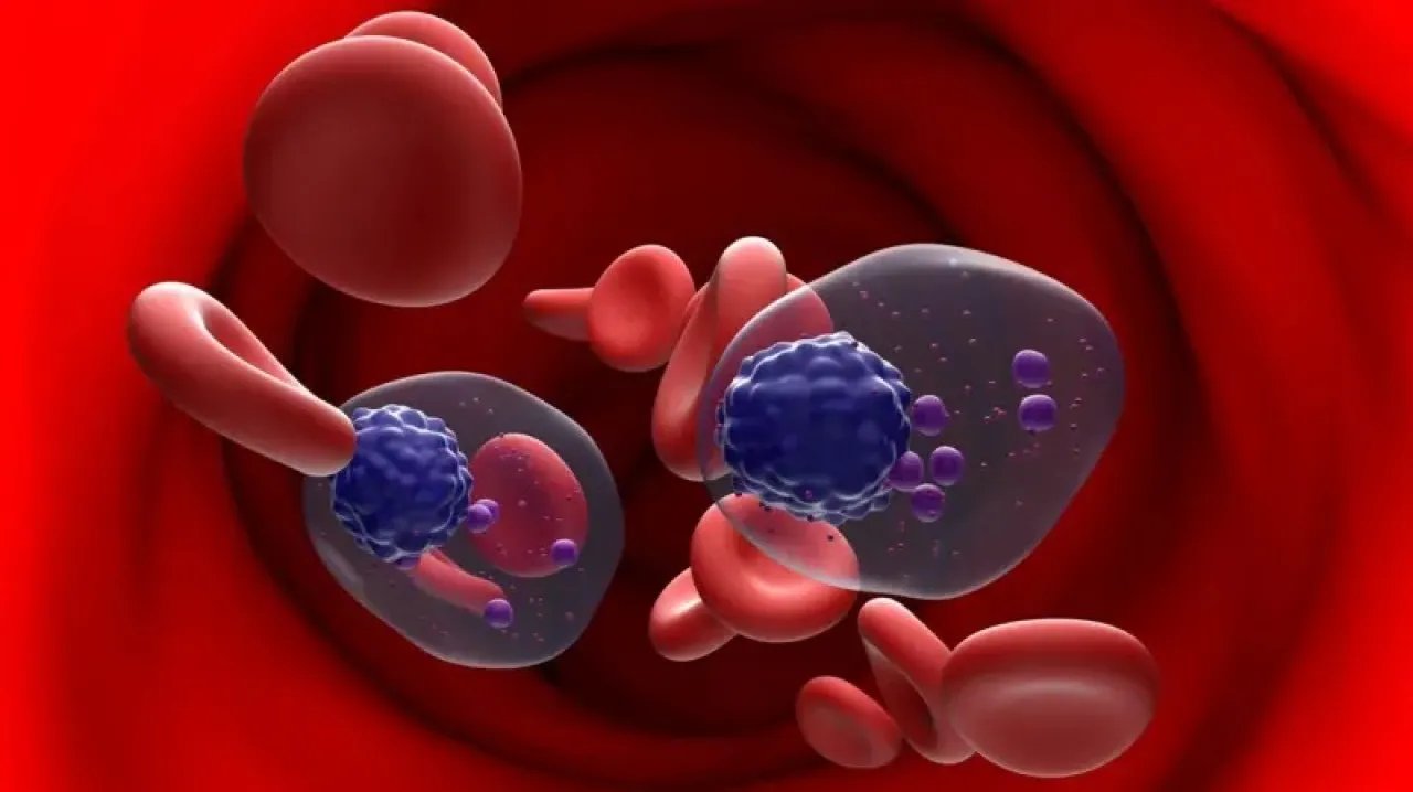 قصة حصان طروادة المعتمَد حديثاً في المملكة المتحدة لعلاج سرطان خلايا البلازما