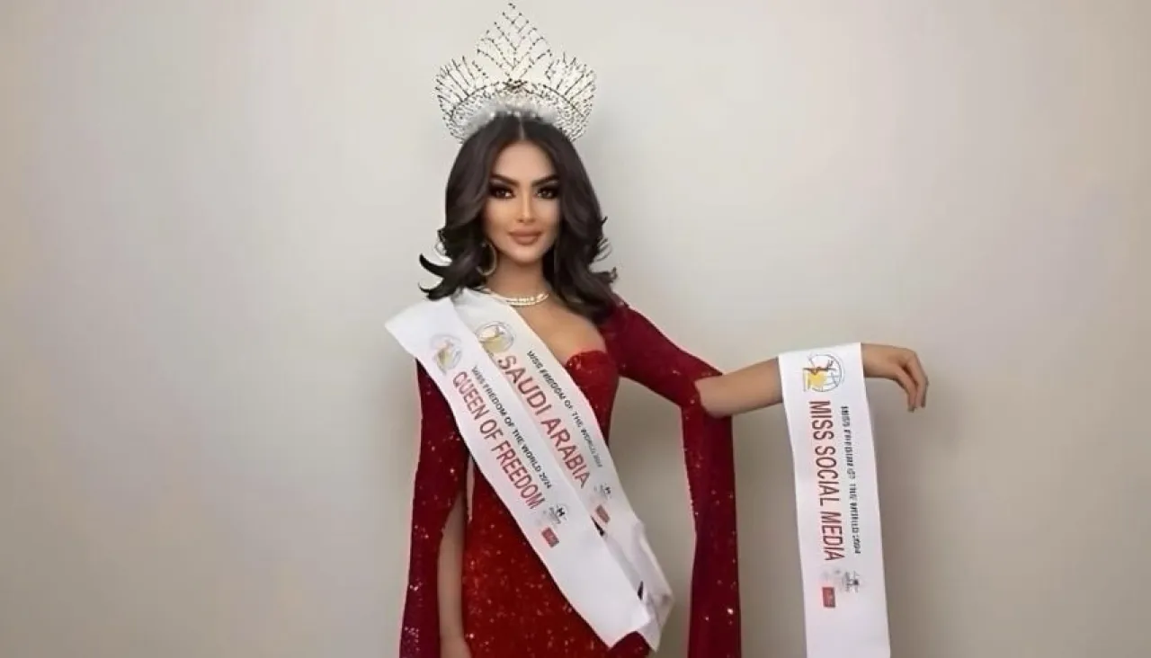 بعد تشوّه وجهها هل تفقد رومي القحطاني فرصتها في تمثيل السعودية بمسابقة عالمية