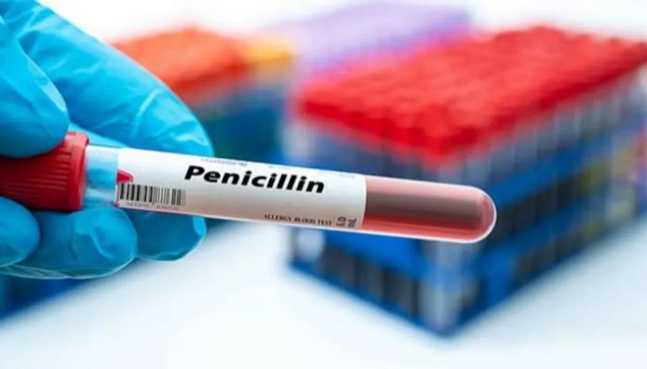 مفاجأة  الحساسية الشائعة قد تكون مجرد تشخيص خاطئ