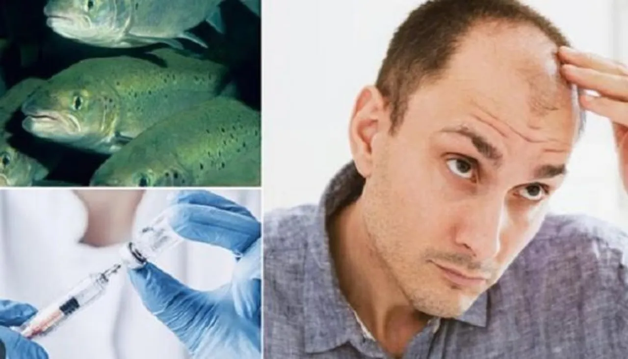 وداعا للصلع علاج ثوري من الحيوانات المنوية لأسماك السلمون