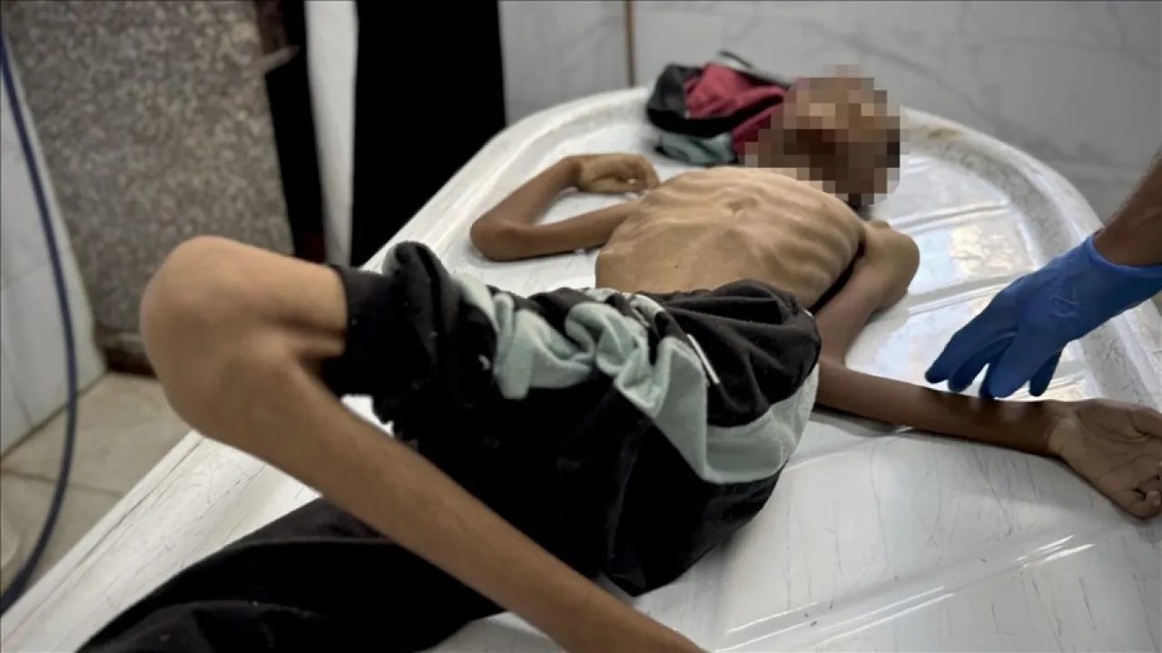 وفاة 15 طفلا خلال 24 ساعة جراء المجاعة في قطاع غزة