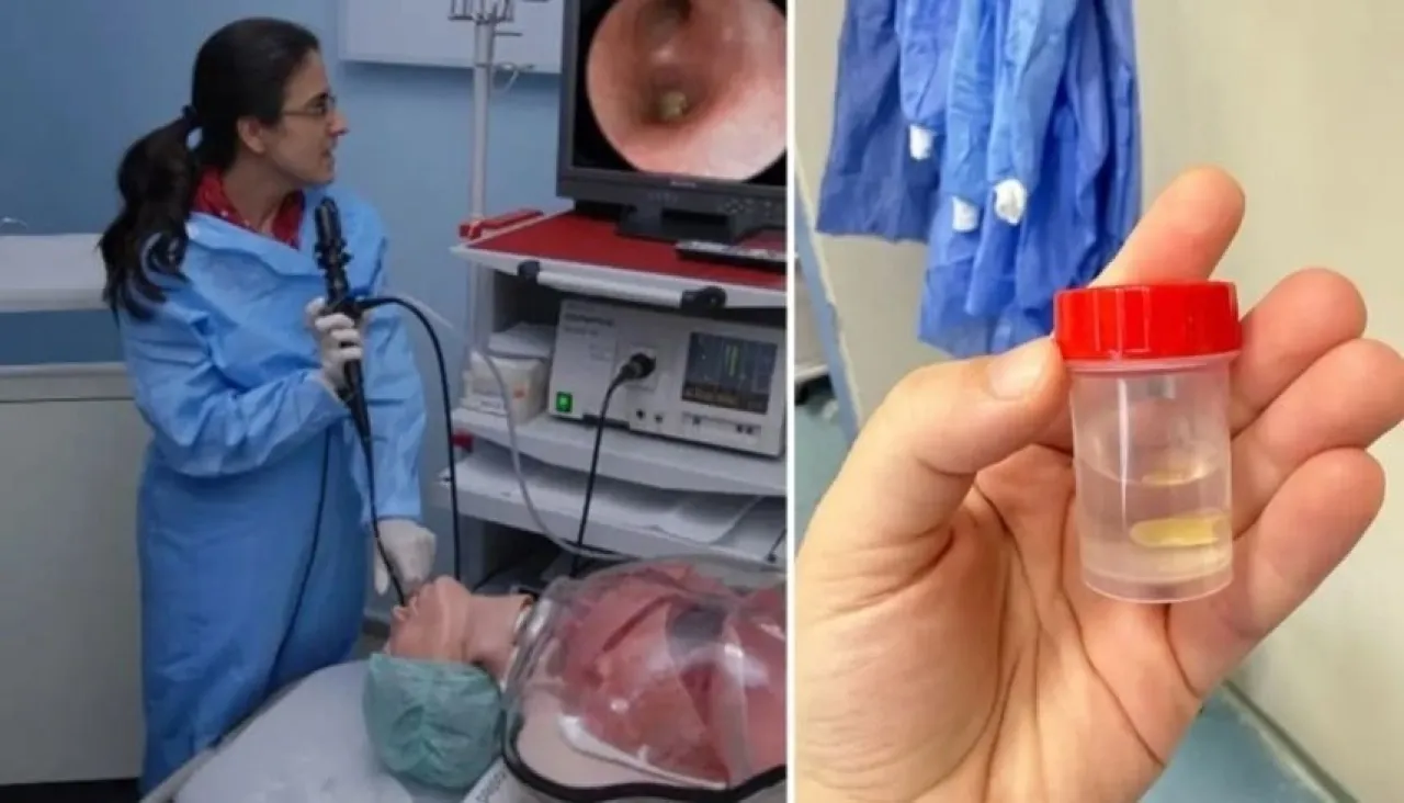 سيدة كادت تفقد حياتها بسبب وجبة أكلتها قبل 5 أشهر