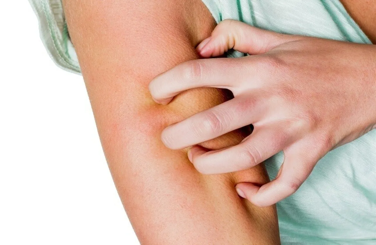 احذر الحكة بعد الاستحمام قد تكون أكثر من مجرد جفاف في الجلد