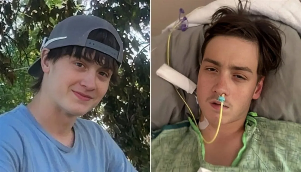 لدغة عنكبوت كادت تقتله مراهق يصارع الموت وينجو بمعجزة