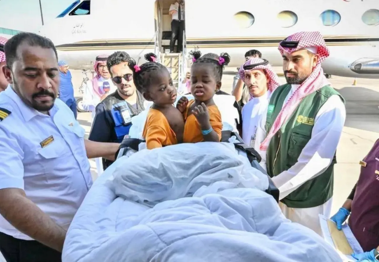 وصول توأمين جامايكيين ملتصقين إلى الرياض لبحث إمكانية فصلهما