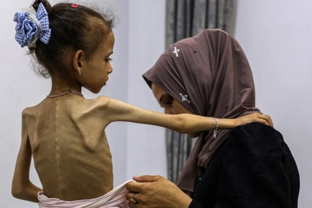 تحذير أممي مؤشرات الغذاء في قطاع غزة تتجاوز عتبات المجاعة