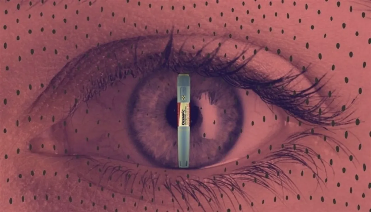 أدلة جديدة على أن حقن التنحيف تهدد بصر مرضى السكري