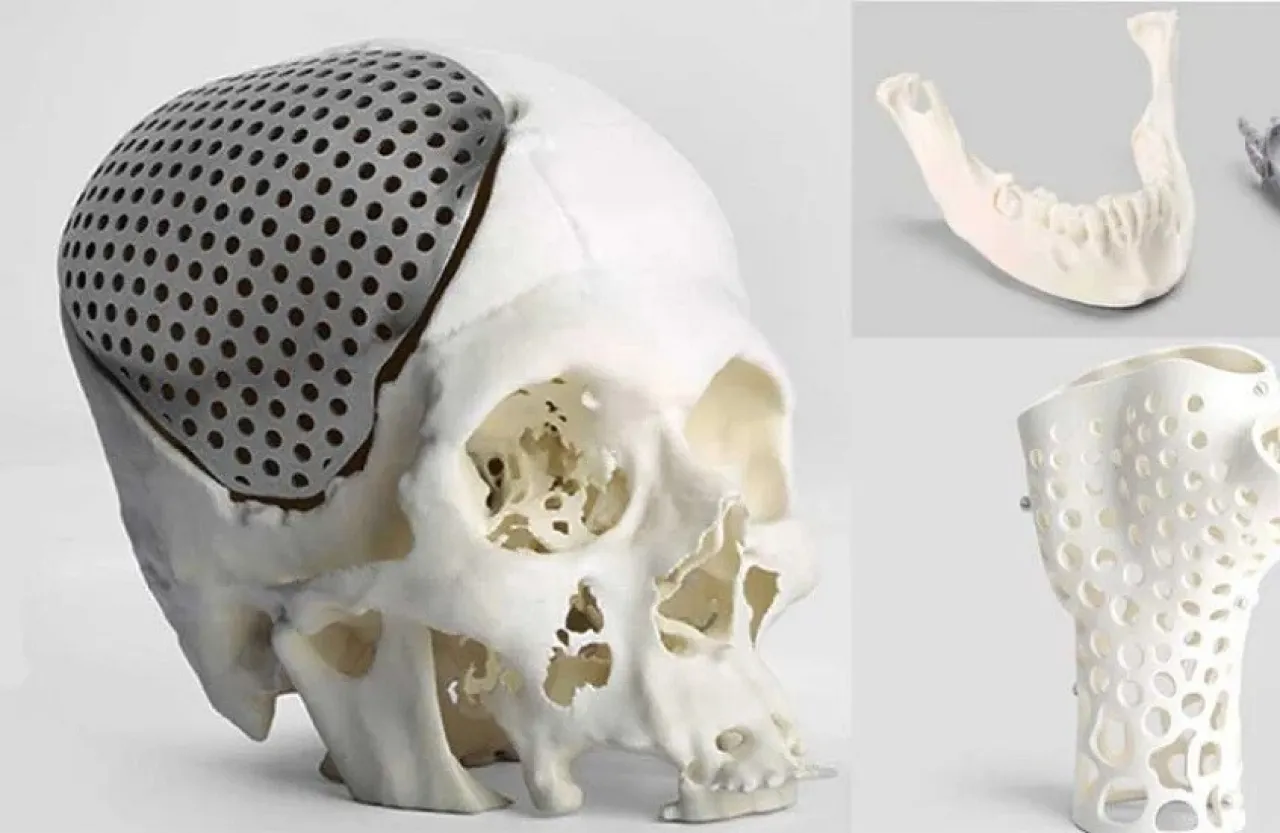 خطوة رائدة في الطب التجميلي أول تجربة لزراعة أنسجة مطبوعة بتقنية ثلاثية الأبعاد