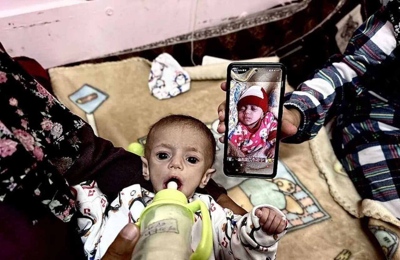 تحذير أممي من استشهاد 132 ألف طفل جوعا في غزة خلال 3أشهر