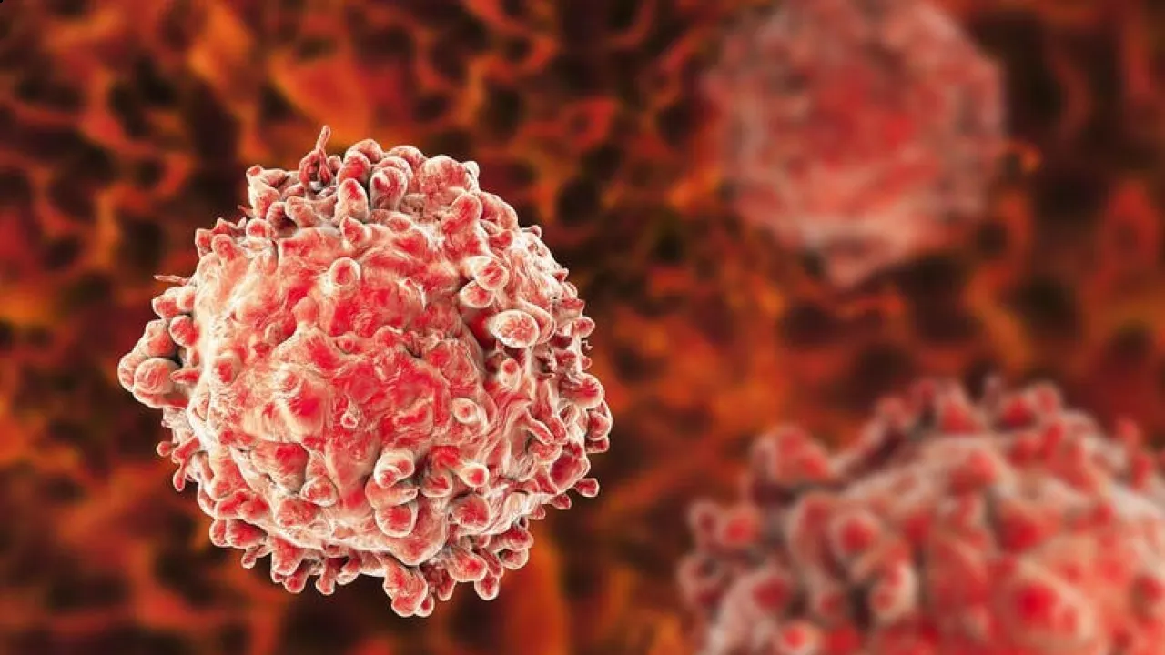 السعودية تسجيل أول دراسة لعلاج سرطان ابيضاض الدم