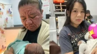 امرأة ماليزية تكشف معاناة 9 أشهر من تغير ملامحها خلال الحمل - W,V