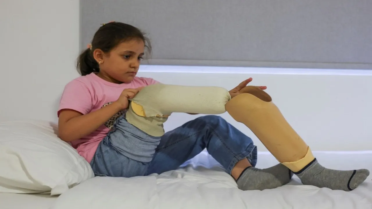 ارتفاع حاد في حالات بتر الأطراف بمستشفيات غزة بسبب نقص المضادات الحيوية