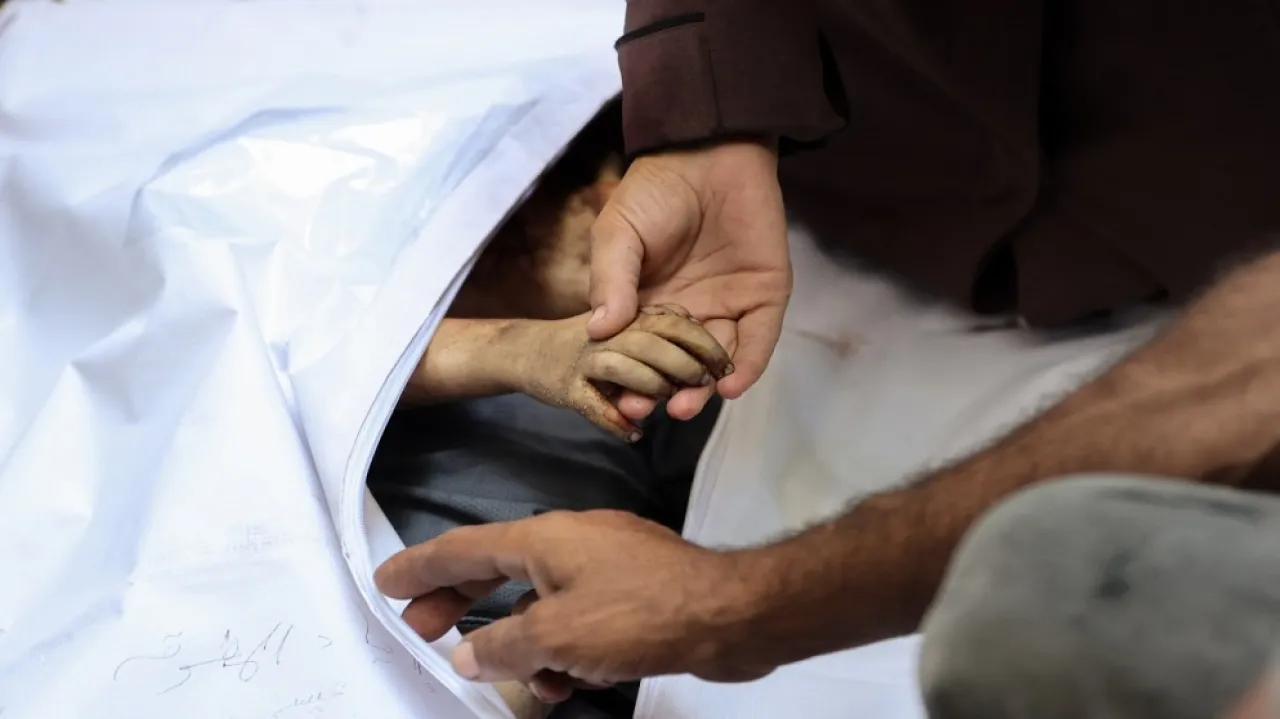 صحة غزة 7 وفيات جديدة بينهم طفلان نتيجة سوء التغذية والمجاعة