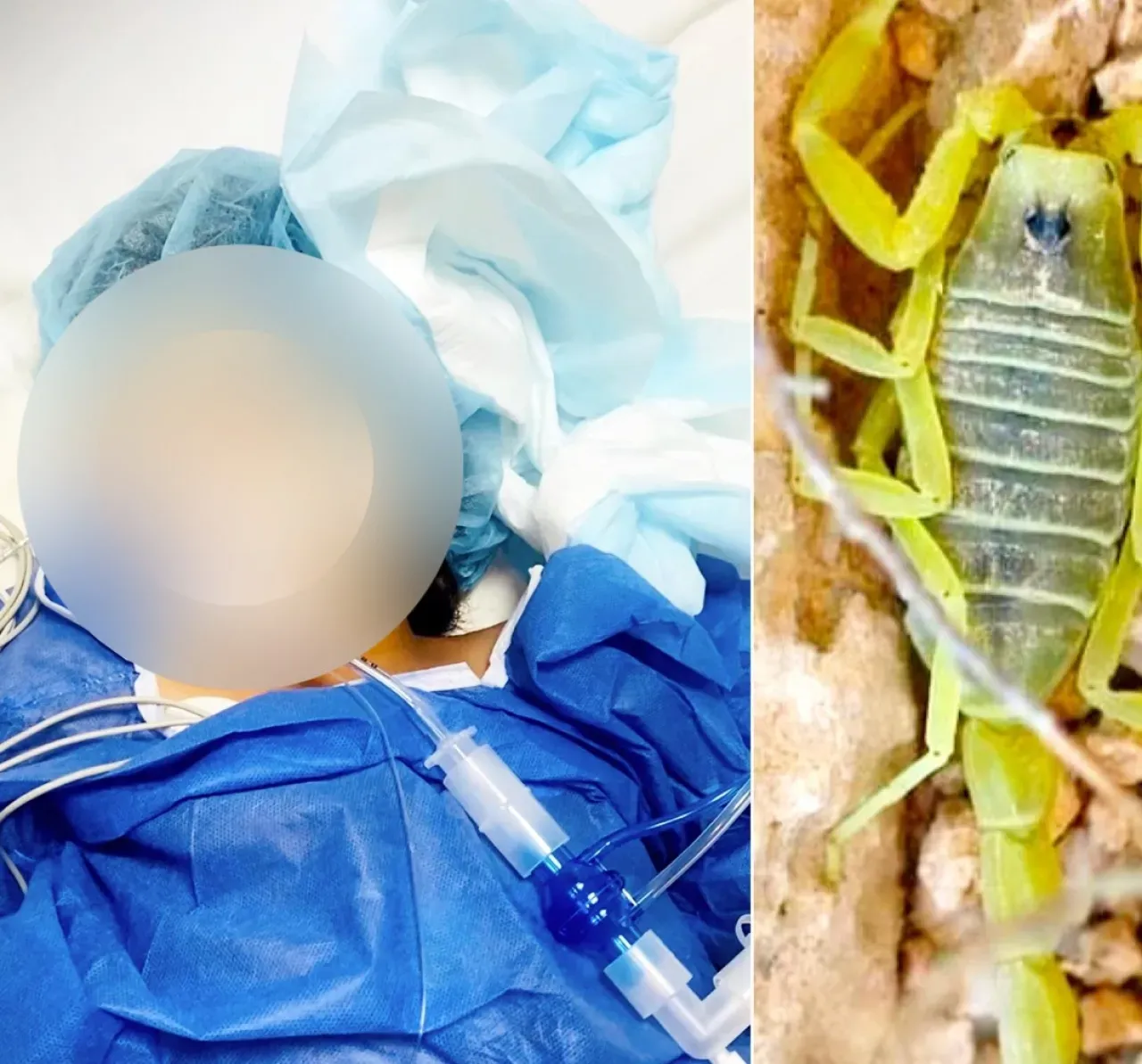 وفاة الطفلة الاردنية رحمة بعد لدغة من أخطر أنواع العقارب  فيديوهات