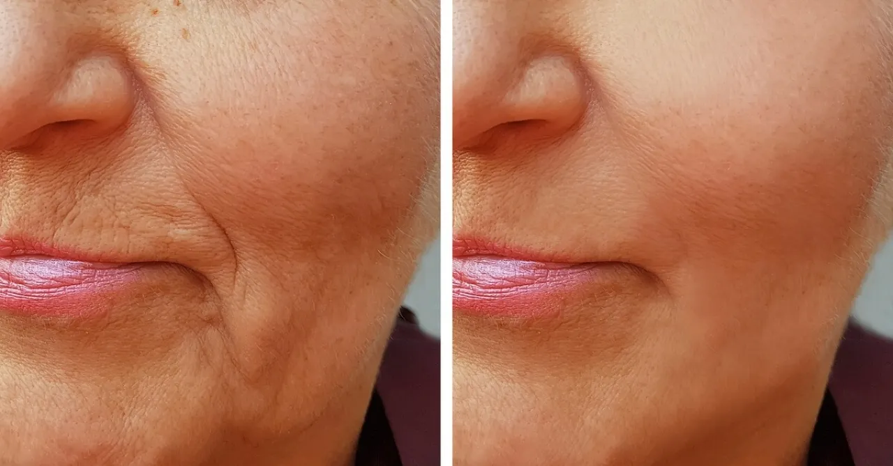 الكولاجين مكمل غذائي أم وهم تجميلي