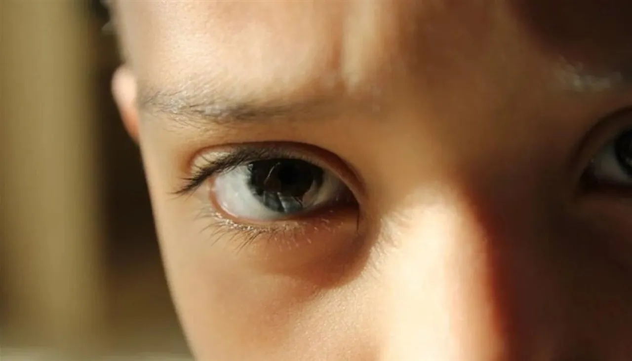 هل تتدهور صحة عيون الأطفال بسبب تلوث الهواء