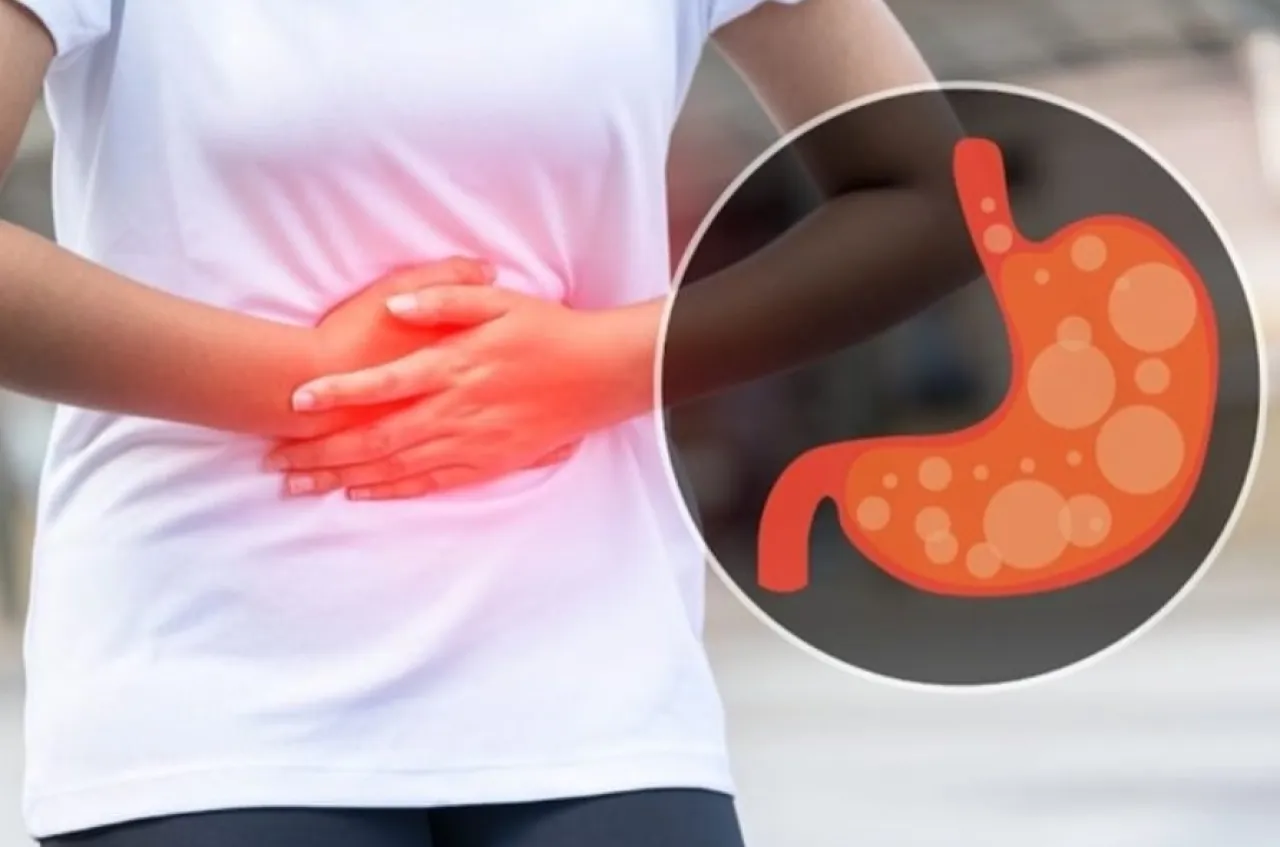 7 أسباب لزيادة غازات البطن يجب معرفتها