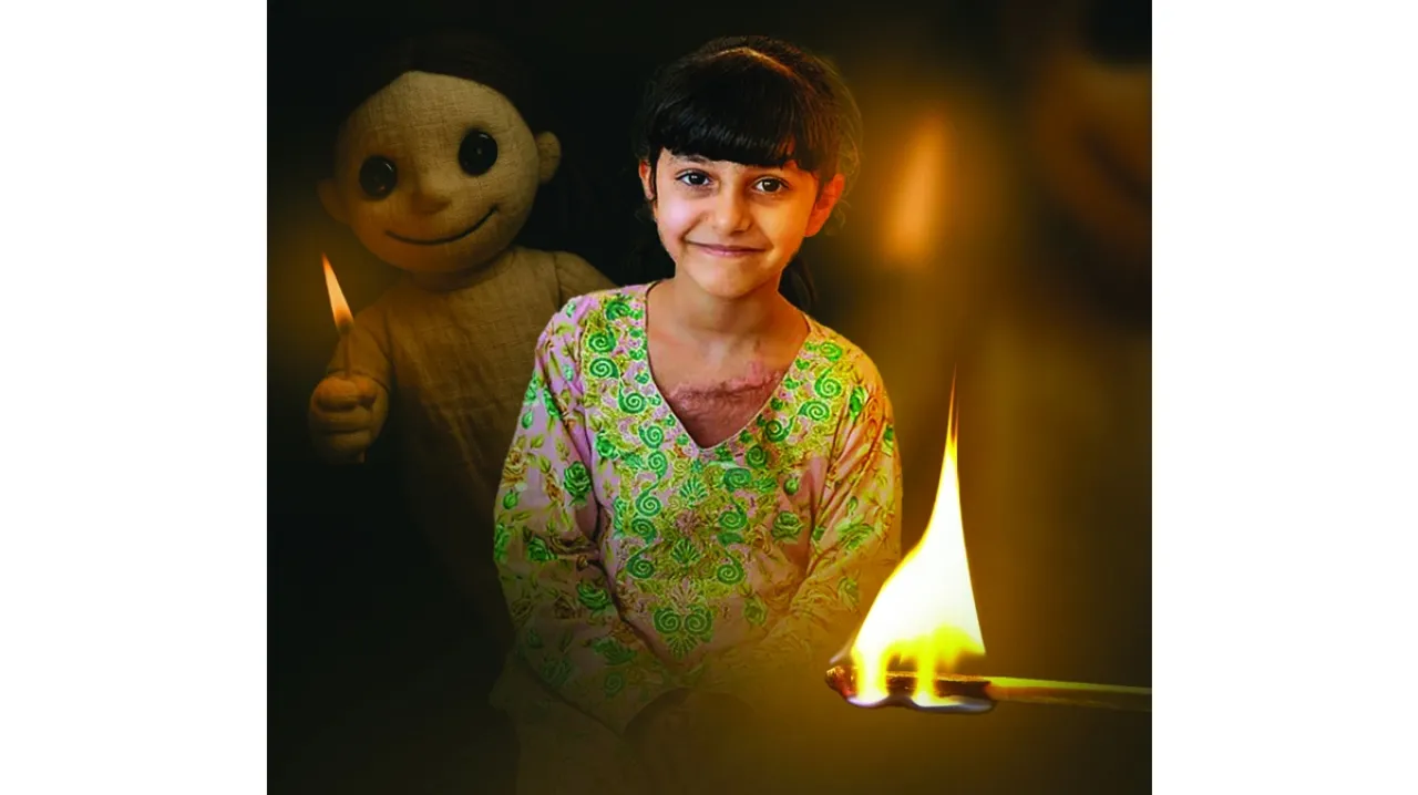 UAE A girl survives severe burns after imitating a trend
