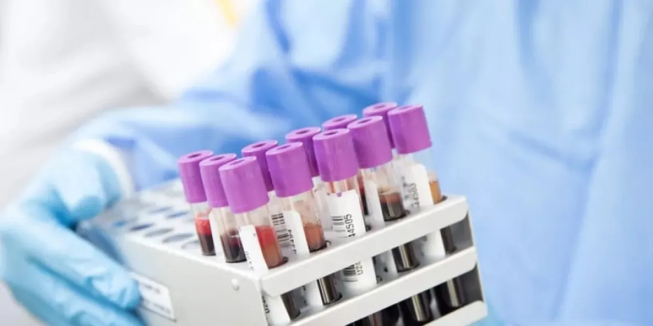 نتائج مشجعة لفحص دم يكشف أكثر من 50 نوعاً من السرطان