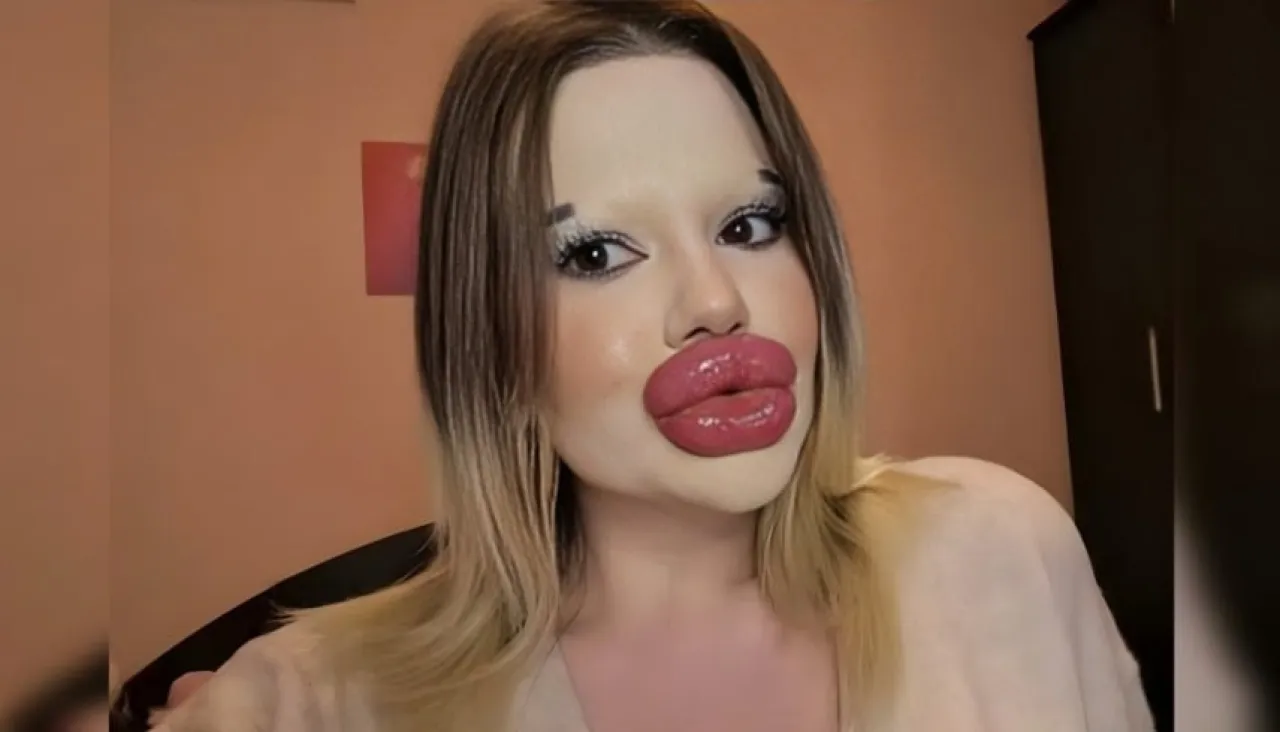 رد ناري من صاحبة أكبر شفاه في العالم على المنتقدين الساخرين