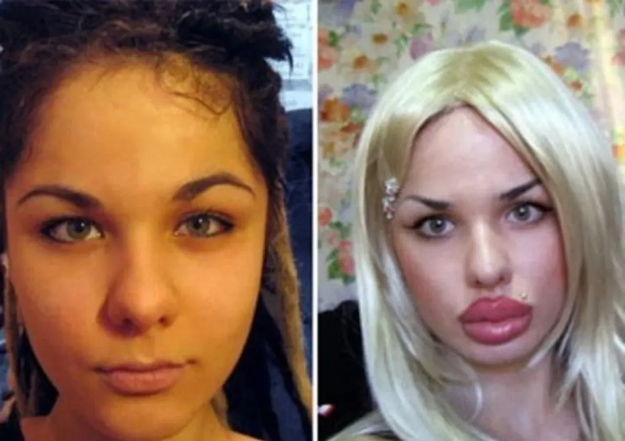 The ruling on cosmetic surgery in Islam Egyptian Fatwa 3 types one of which is forbidden