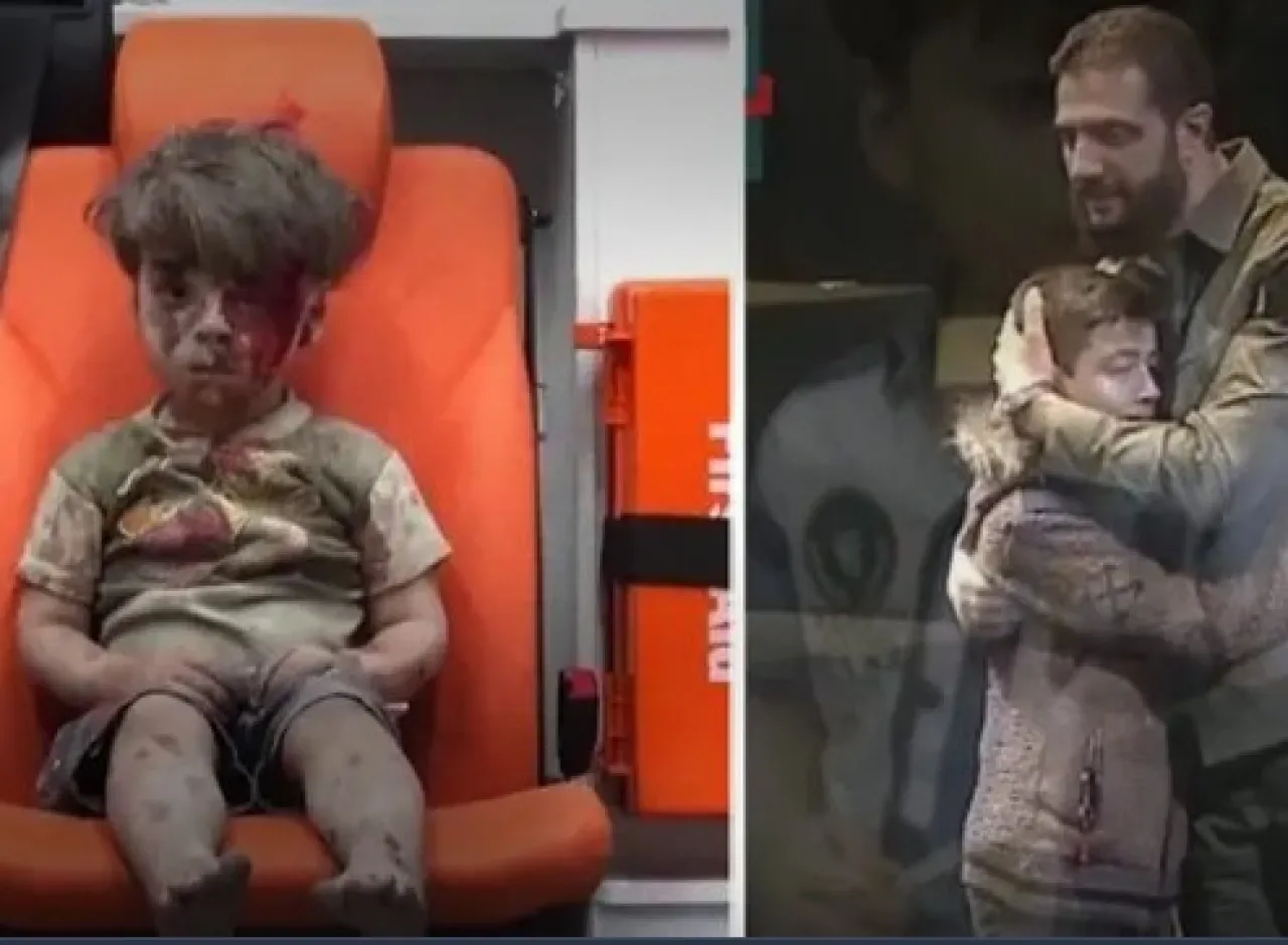 His image shook the world The child Omran narrates his story and AlShara embraces him