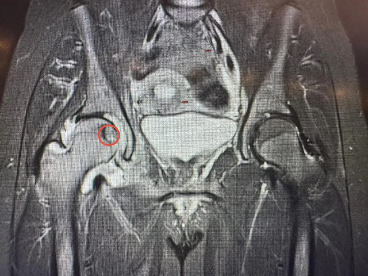 تدخلٌ علاجيٌّ نوعيّ في مستشفى الجامعة الأردنيّة