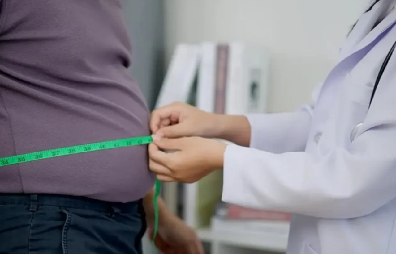 Study Obesity Accelerates Alzheimers Development