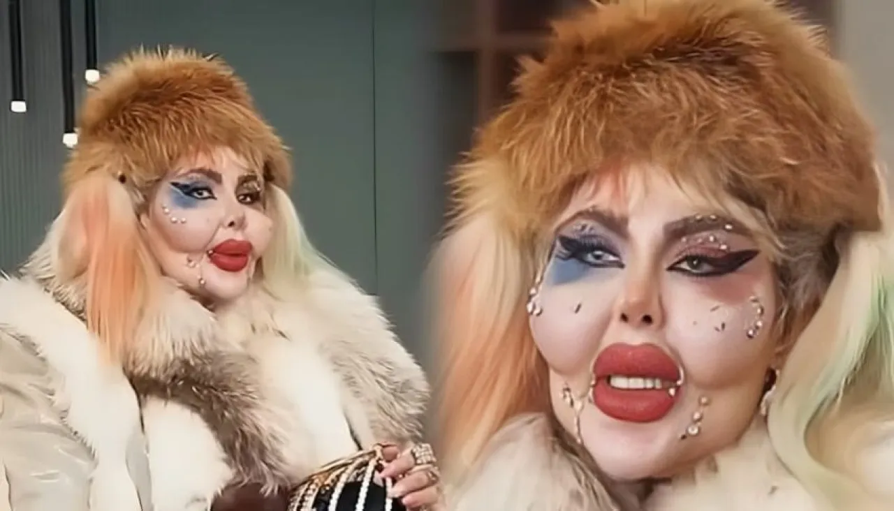 388 عملية تجميل و8 سنوات بلا طعام بلوغر شهيرة تثير جدلاً بسر رشاقتها المروع