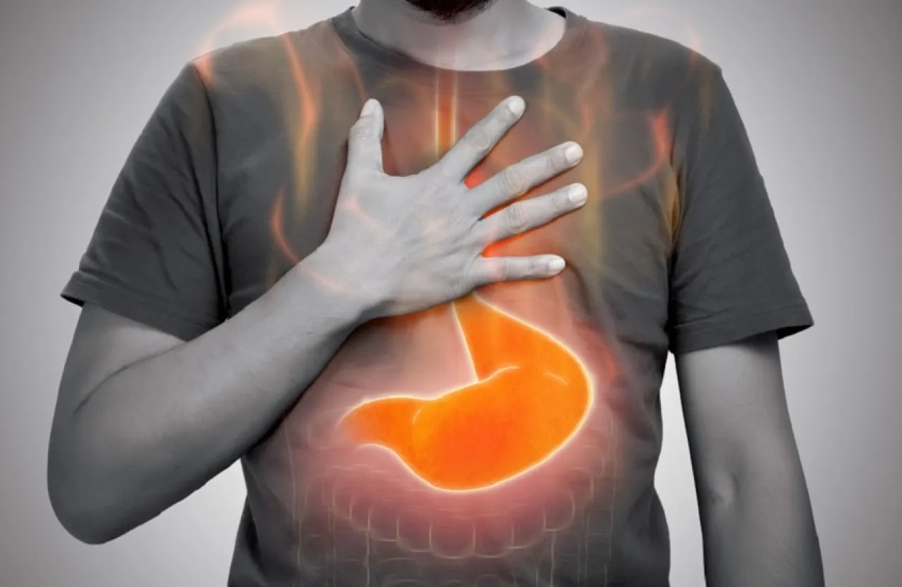 ما هي أسباب حرقة المعدة لدى المراهقين؟ 