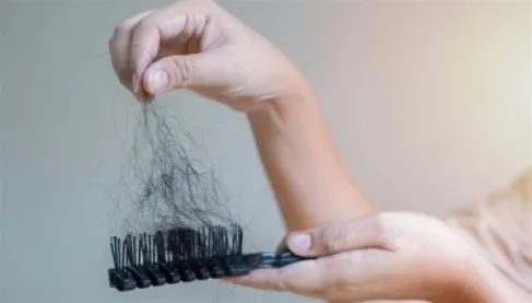 دراسة تكشف كيف يسبب التوتر تساقط الشعر