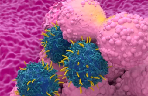 استراتيجية مبتكرة ضد أكثر أنواع سرطان الثدي انتشارا