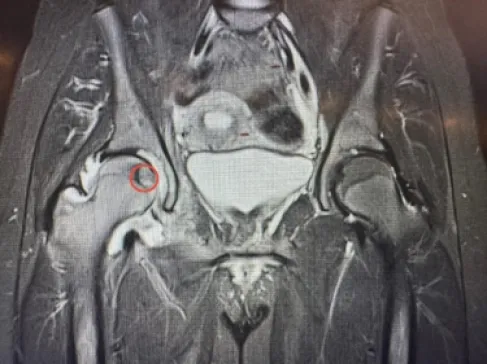 تدخلٌ علاجيٌّ نوعيّ في مستشفى الجامعة الأردنيّة