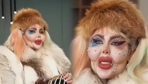 388 عملية تجميل و8 سنوات بلا طعام.. بلوغر شهيرة تثير جدلاً بسر رشاقتها المروع