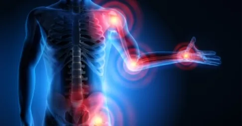 3 مكملات غذائية قد تحمي مفاصلك وتخفف تيبسها