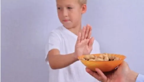 حساسية الفول السوداني عند الأطفال.. دراسة تكشف طريقة وقائية جديدة