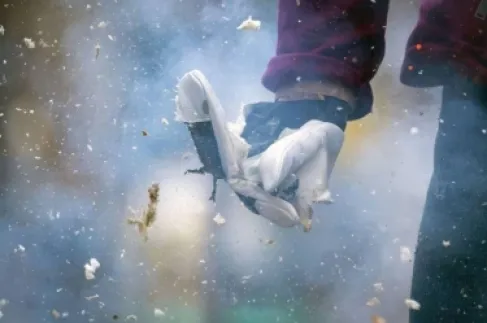 ‫الإسعافات الأولية للإصابات بالألعاب النارية