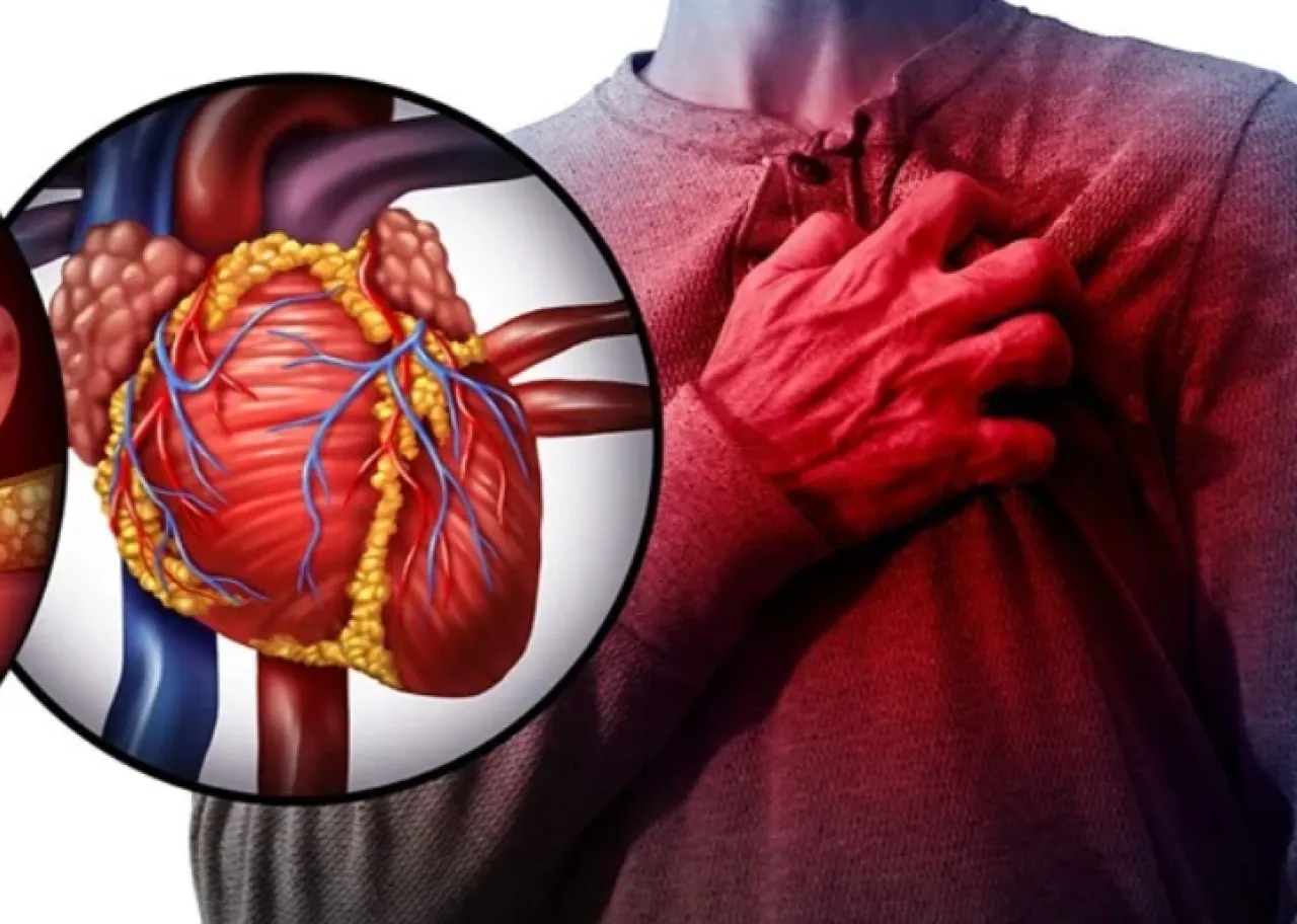 أعراض للنوبة القلبية تظهر قبل أسابيع من حدوثها 